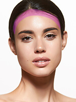 Лазерная эпиляция - линия лба