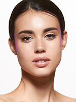 Лазерная эпиляция - виски