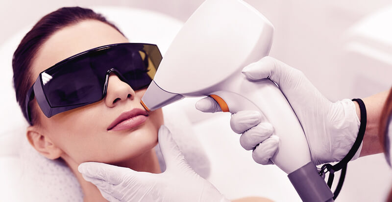 Лазерная эпиляция лица