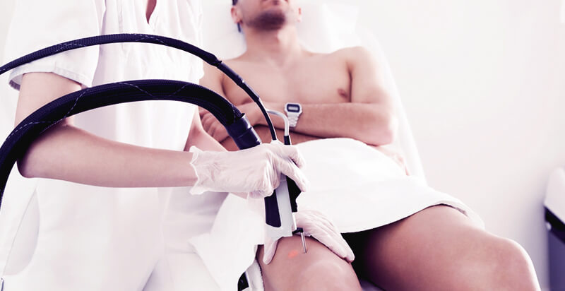 Лазерная эпиляция волос на ногах у мужчин